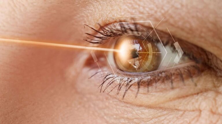 ליייזר בעין